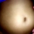 My bloated gassy belly.