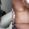 woman chubby b&a