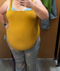 wgbeforeafter Extreme-Tooth-1043 1jr6vhk 2