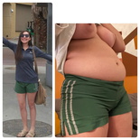 wgbeforeafter babychubs21 khip2e