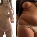 wgbeforeafter babychubs21 mwg97w