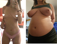 wgbeforeafter babychubs21 ny9x89