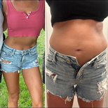 wgbeforeafter fitbellybaby1 19asz3m 2
