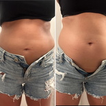 wgbeforeafter fitbellybaby1 19asz3m 3