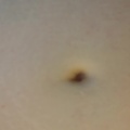 My belly button has changed!