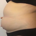belly gaining