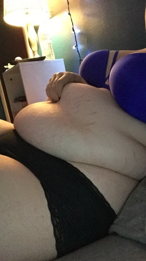 153502799975 stretch marks galore ive been feeling_4.jpg