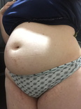 150457198741 todays belly