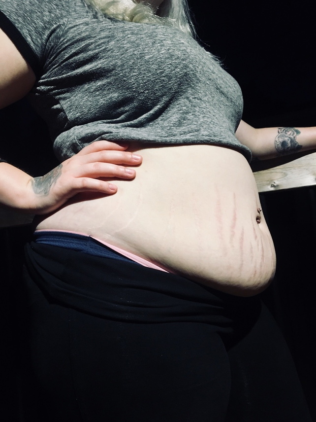 176216526941 she has the sexiest stretch marks ive.jpg
