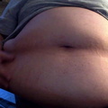 Fat aching belly