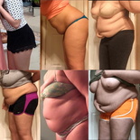 fatty progression