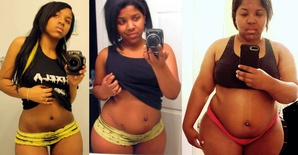 Alexis Salomon before-after 2
