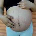 Simple_pregnant_belly_with_stretch_marks.mp4