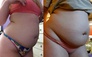 Muffint0pbelly b&amp;a