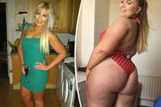 WOMAN-BEFORE-AND-AFTER-WEIGHT-GAIN-662178