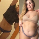 WOMAN-BEOFRE-AND-AFTER-WEIGHT-GAIN-1149566